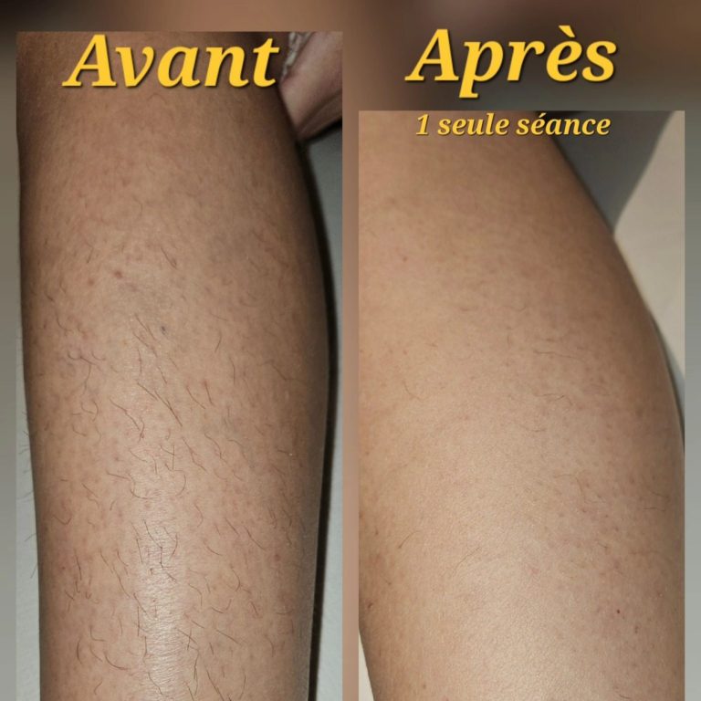 Silféa, Silfea, Cilfea, Cilphea