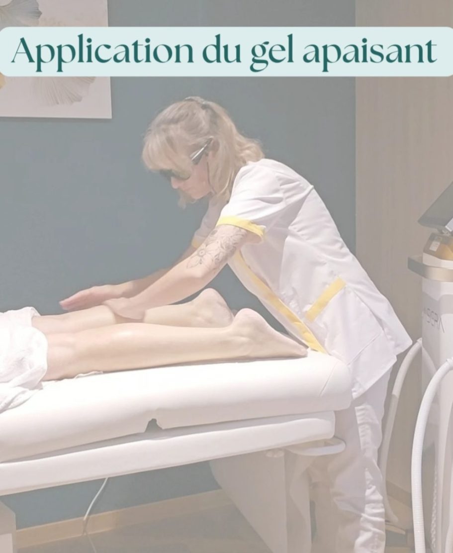 Gel apaisant post séance laser Application d'un gel apaisant sur les jambes d'une cliente par un professionnel de santé, après la séance d'épilation laser