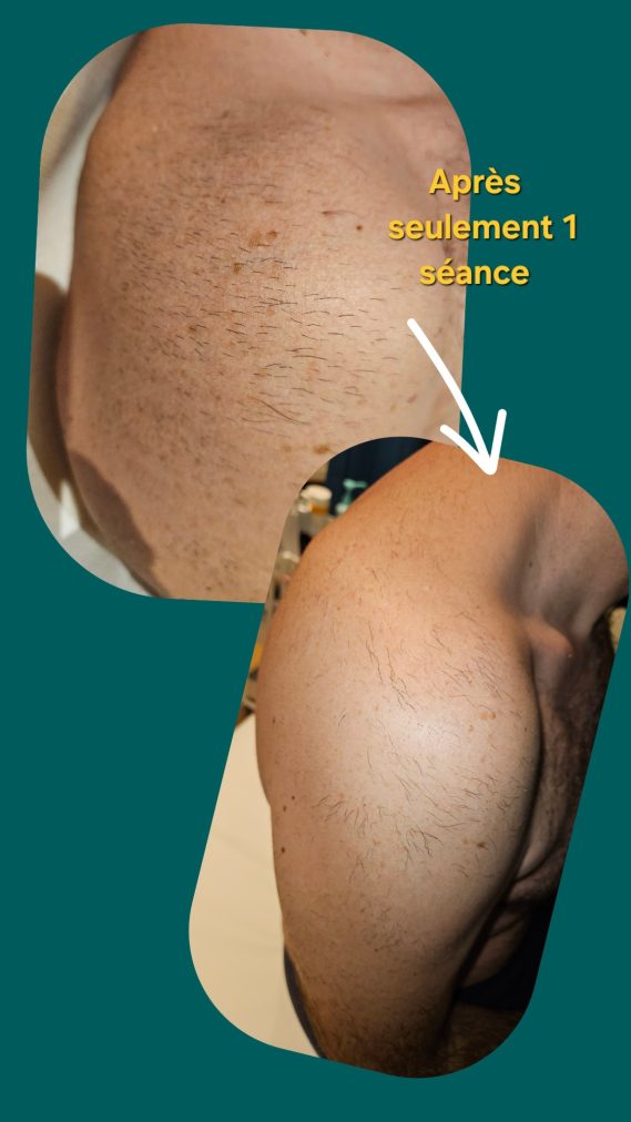 résultats avant/après